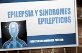 convulsiones, epilepsia y sindromes epilepticos   sin videos