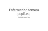 Enfermedad femoro poplítea.pptx david (1)