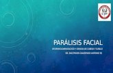 Paralisis facial aguda y cronica
