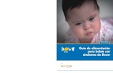 Guía de alimentación para bebés con síndrome de Down