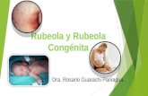 Presentación de la enfermedad de la Rubeola Y Síndrome de Rubeola congénita.