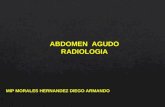 Abdomen agudo en radiologia