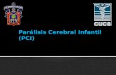 Osteogenesis Imperfecta y PCI (Paralisis Cerebral Infantil).