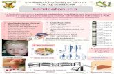Fenilcetonuria cartel