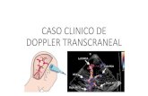 Caso clínico doppler transcraneal.