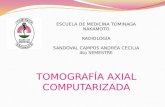 TOMOGRAFÍA AXIAL COMPUTARIZADA