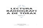 (2016.03.29) Lectura de Radiograf­a de T³rax (Parte 1) (DOC)