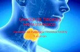 Cancer de tiroides metastatatico