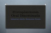 Histoplasmosis oral diseminada