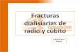 Fracturas diafisiarias de radio y cubito