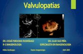 Valvulopatias en Imagenolog­a