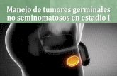 Gestión de tumores germinales no seminomatosos en estadio