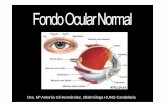 Dra. Mª Antonia Gil Hernández, oftalmóloga HUNS CandelariaFONDO+OJO… · Fondo de ojo normal, joven (con reflejos) Fondo de ojo normal. ... Vena Arteria Vena Arteria. Cruce arterio-venoso.