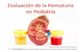 Evaluación de la Hematuria en Pediatría - Inicioareasaludbadajoz.com/images/stories/hematuria_pediatria.pdf · ... del tracto superior o de la vejiga. Según la cantidad de ...