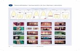 1 Generalidades: restauración de los dientes · PDF filebase para la restauración de caries. Mientras que, ... colos menos invasivos como el blanqueamiento o las obturaciones ...