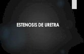 ESTENOSIS DE URETRA - SBU Cbbasbu-filial-cbba.com/Archivos/EE-AA_ESTENOSIS URETRA Dr.Lazcano.pdf · de longitud de estrechez, el riesgo de recurrencia se incrementó en 1,22 .Se recomienda