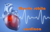 Muerte súbita cardiaca · PDF file- Taquicardia ventricular hemodinamicamente inestable. - Fibrilación ventricular - Actividad eléctrica sin pulso (PEA)