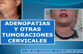 ADENOPATIAS Y OTRAS TUMORACIONES …policlinicosanmiguel.com/.../12/ADENOPATIAS-CERVICALES.pdf-APELOTONAMIENTO Y EDEMA PERINODAL -VASCULARIZACION BENIGNA/MALIGNA GANGLIOS LINFOMATOSOS