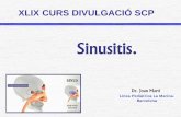 Sinusitis. - · PDF file9Asma 9Fibrosi quística. 9Immunodeficiències. 9Disfunció ciliar. 9Reflux G - Esofàgic. 9Alteracions anatòmiques..... Sinusitis. ETIOLOGIA. 9VIRUS (80%)