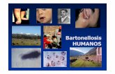 BartonellosisBartonellosis HUMANOSHUMANOS - BVS … · bacilliformis causes a broad spectrum of disease ... Febril: 06 2. Otros síntomas generales: 01 3. Asintomáticas: 09 4. Fase