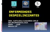 DRA. KATIUZKA CASARES CRUZ …sdr.com.do/wp-content/uploads/2014/11/ENFERMEDADES-DESMIELINI… · gliosis. No refuerzan . Localización: En la sustancia blanca periventricular, cuerpo