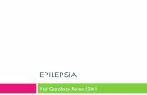 EPILEPSIA - santateresa.com.mx€¦ · Temario Epidemiología Historia y conceptos Definición y clasificación Diagnóstico temprano de epilepsia Diagnóstico diferencial