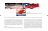 160 SECCIÓN 3 / TRATAMIENTO DEFINITIVOmedia.axon.es/pdf/115871_5.pdf · exposición tan alta como la arteria axilar distal. ... La arteria radial contiene solo una rama en la ...