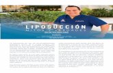 LIPOSUCCIÓN - drlopeztallaj.com Grande/liposuccion... · Cirugía de la Mano en el Hospital General Santa Casa de la Misericordia de la Ciudad de Río de Janeiro, en el Brasil. Es