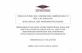 FACULTAD DE CIENCIAS MÉDICAS Y DE LA SALUD …repositorio.uide.edu.ec/bitstream/37000/396/1/T-UIDE-0375.pdf · 1 rehabilitaciÓn con prÓtesis fija de metalporcelana en el sector