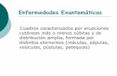 EPIDEMILOGIA MOLECULAR DE ECHOVIRUS 30 EN … · En el año 2009 se identificaron 3 casos en Argentina relacionados ... Tambien se detectan IgA, ... - 2do trimestre 12,5% ...