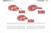Capítulo 15 Enfermedad de reflujo gastroesofágico y hernia ...media.axon.es/pdf/115883_5.pdf · Los paneles de la derecha representan la apariencia endoscó - ... Capítulo 15 Enfermedad