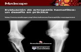 Evaluación de artropatía hemofílica: un desafío en …img.medscape.com/images/826/162/826162_reprint_spa.pdf · El objetivo de esta actividad es examinar las estrategias óptimas