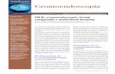 Cromoendoscopia - AEEHaeeh.es/wp-content/uploads/2012/05/v8n6a576pdf001.pdf · endoscopia convencional con luz blanca. en cuanto a la posibilidad de predecir la histología de las