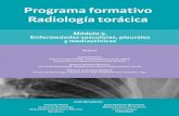 Programa formativo Radiología torácica · pulmonar idiopática. Enfermedades parenquimatosas es el mó-dulo 4 y tiene como objetivo principal pro-porcionar al alumno los conocimientos