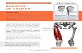 BURSITIS DE CADERA - yoga-terapeutico.comyoga-terapeutico.com/Articulos-pdf/02-Bursitis/Bursitis.pdf · Tenemos bursas, en la rodilla, en el ... ve óseo del fémur, situado la altura