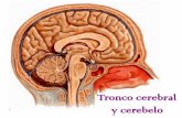 Tronco cerebral y cerebelo - … · El cerebelo es activo en el aprendizaje y la realización de movimientos. Es el órgano de la coordinación y la destreza motora. También participa