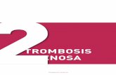 TROMBOSIS VENOSAcatedratrombosis.com/wp-content/uploads/2016/11/cursoTROMBOca… · • trombosis venosa profunda sintomática • trombosis venosa profunda asintomática Y finalmente