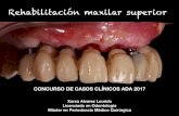 Rehabilitación maxilar superior - …auladentalavanzada.com/wp-content/uploads/2017/12/Xurxo-Alvarez... · CONCURSO DE CASOS CLÍNICOS ADA 2017 Rehabilitación maxilar superior Xurxo