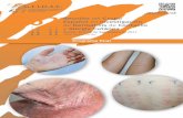 62 Reunión Español Investigación …bocemtium.com/geidac/2017/wp-content/uploads/2016/07/Programa... · Reunión del Grupo Español en Investigación de Dermatitis de Contacto