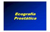 22.- Ecografia prostatica [Modo de compatibilidad] · • Está alojada en el compartimiento o nicho prostático inmediatamente por debajo de la ... Al tacto rectal la próstata esta