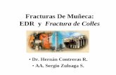 Fracturas De Muñeca - udec.cljlefimil/Fractura_de__Colles.pdf · 2. TÉCNICA DE LA REDUCCIÓN. 1. Enfermo en decúbito dorsal. 2. Miembro Superior con hombro abducido y codo en flexión