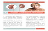 32 Diagnóstico y clasificación del cáncer de riñón · Información a pacientes - Diagnóstico y clasificación del cáncer de riñón Página 3 / 6 Si usted es alérgico al contraste