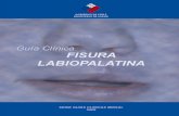 Guía Clínica 2009 Fisura Labio Palatina - minsal.cl · otitis media con efusiÓn (ome) cirugia paladar completo (cirugÍa primaria) impedanciometrÍa y evaluaciÓn audiolÓgica: