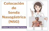 Profesor: Licenciado Hugo Carrasco · para sondaje gástrico. • Tubos de mayor longitud; (180 y 300 cm.) para descompresión intestinal. • Sondas de uso gástrico: ... (NSG) •