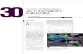 Punción-Biopsia guiada por ultrasonografía endoscópicaendosonografia.com/wp-content/uploads/2016/04/capitulo-30-mitad.pdf · 422 Simone Guaraldi ecoendoscopio de barrido lineal