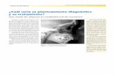 ¿Cuál sería su planteamiento diagnóstico y su …scielo.isciii.es/pdf/maxi/v27n3/residente.pdf · Avance geniogloso en el tratamiento del síndrome de apnea obstructiva del sueño