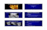 Modalidades radiológicas en la valoración de las ... · Tumefacción de tejidos blandos periarticulares (simétrico y normalmente fusiforme) Aplicación Multimedia para la Enseñanza