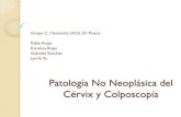 Atlas. Patología No Neoplásica del Cérvix y Colposcopía · Una biopsia dirigida por colposcopia para confirmar la afección. Procedimiento de escisión por LEEP, el cual utiliza