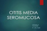 OTITIS MEDIA SEROMUCOSA - sborl.essborl.es/wp-content/uploads/2018/04/OMNS-Miguel.pdf · Otitis media con derrame, otitis media secretora, ... - Retraso del desarrollo del lenguaje