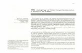 MR Imaging in Neurocysticercosis - AJNR · ersidad Autonoma de Nuevo Leon, Apdo. Postal 4469, Monterrey, N. L. Mexico. Address reprint ... MR Imaging in Neurocysticercosis: A Study